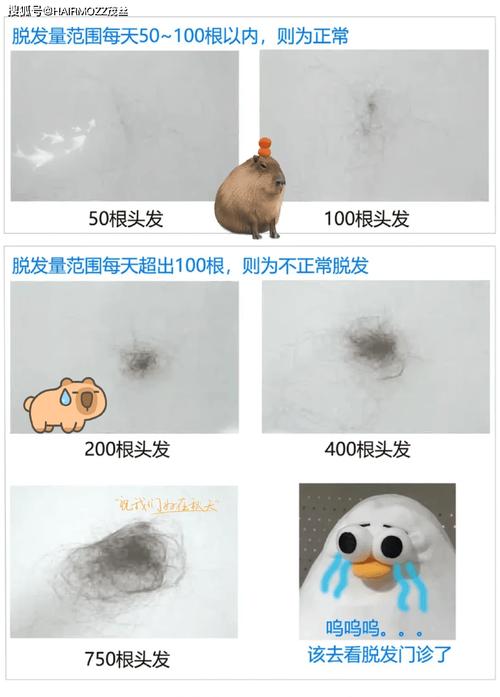 新门内部资料最快更新和因发量太多剃掉头发与因发量太多剃掉头发会怎么样